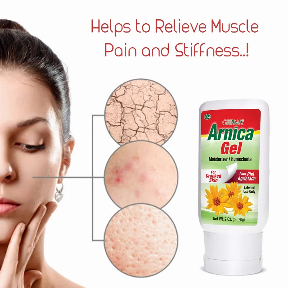 Pack of 6. 2 oz. Pain and Ache Relief for Bruises / Arthitis. Moisturizer for Cracked Skin. Natural Topical Analgesic. Germa Arnica Gel